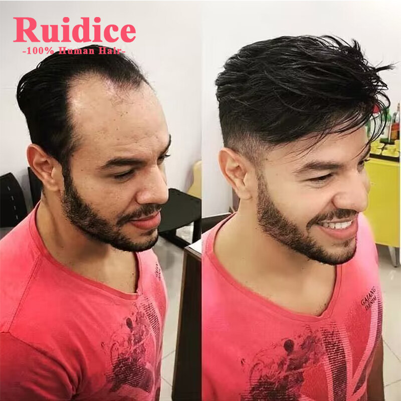 Ruidice Men Toupee Hairpieces 100% European Human Hair Fine Mono Toupee For Men Natural Hairline Hairpieces Men Replacement Wig