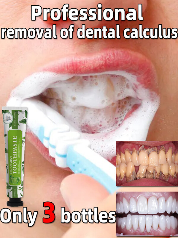 remover dental calculus whitening teeth mouth odor removal bad breath Preventing Periodontitis