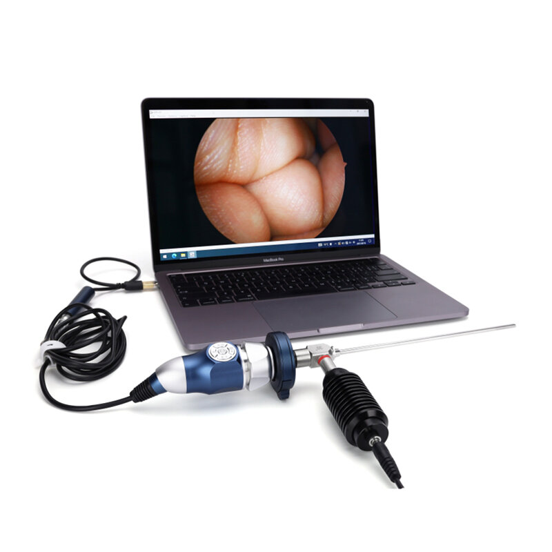 كاميرا التنظير الطبي الجراحية المحمولة ، الأنف والحنجرة ، USB ، كامل HD ، HDMI
