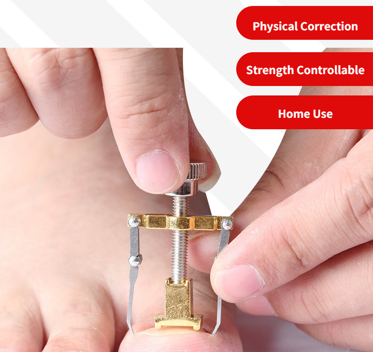 Clip lisciante correttore unghia incarnita Pedicure strumenti per la cura delle unghie dei piedi trattamento Pedicure in acciaio inossidabile correzione onice