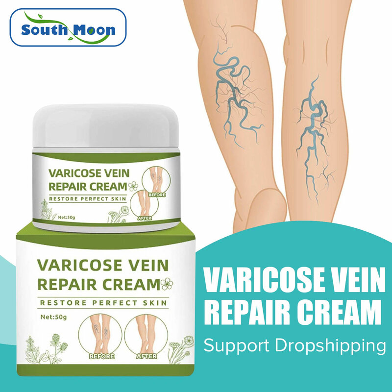 Varicose Vein Repair ครีม Tongmai ที่มีประสิทธิภาพช่วยลดขา Bulge Pain Treatment ครีม Vasculitis Phlebitis ลบ Vein 50G