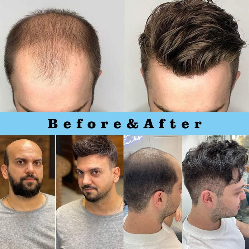Tupé de cabello humano europeo para hombres, postizos naturales delanteros de encaje suizo, piel fina de 0,08mm, peluca de repuesto de cabeza completa de PU, 8x10