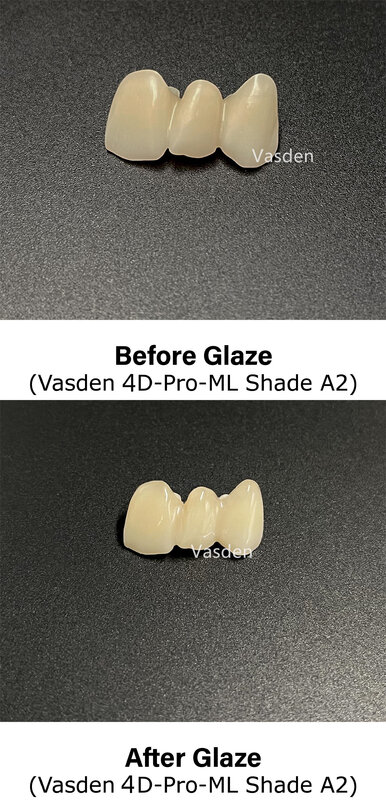 Pasta per smalto per macchie dentali 4g pasta per smalto 3D pasta per vetri e pasta per denti in Zirconia materiale per forniture dentali