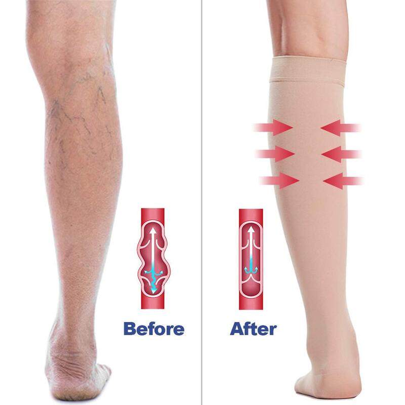 Meias de alta compressão de joelho aberto para mulheres e homens, varizes, voo de edema, firme 20-30 mmHg, suporte graduado