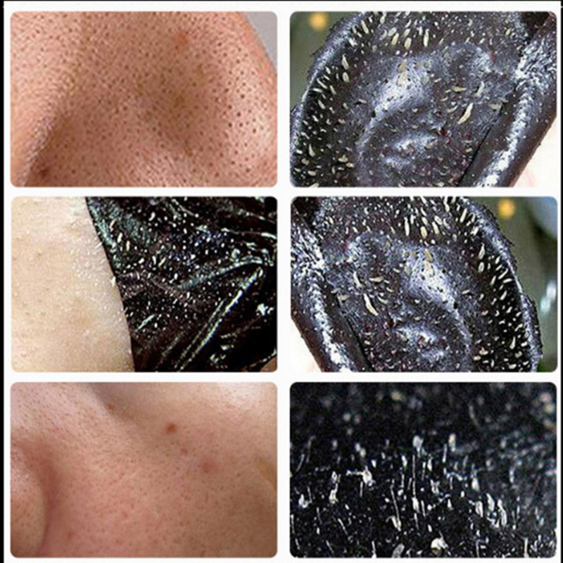 1Pcs Vulkanischen Schlamm Mitesser Entfernen Bleaching Serum Gesicht Feuchtigkeits Creme Anti Falten Gesicht Feinen Linien Behandlung Hautpflege