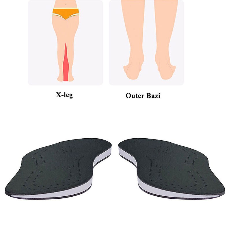 Unisex Leather O/X Leg Orthopedic Insoles Correction Shoe Inserts Men Women Foot Knock Knee Pain Bow Legs Valgus Varus Shoes Pad