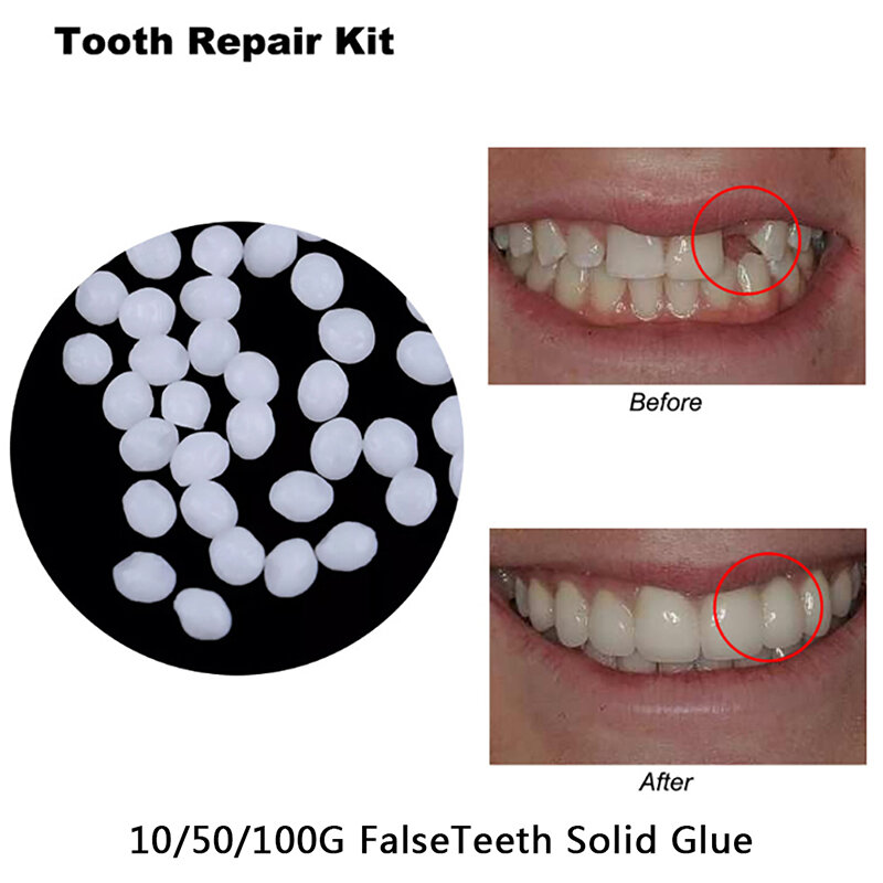 Resina de cola sólida Falseteeth, Reparação Temporária do Dente, Adesivo Dentário, Dentista, Dentes e Lacuna, 10g