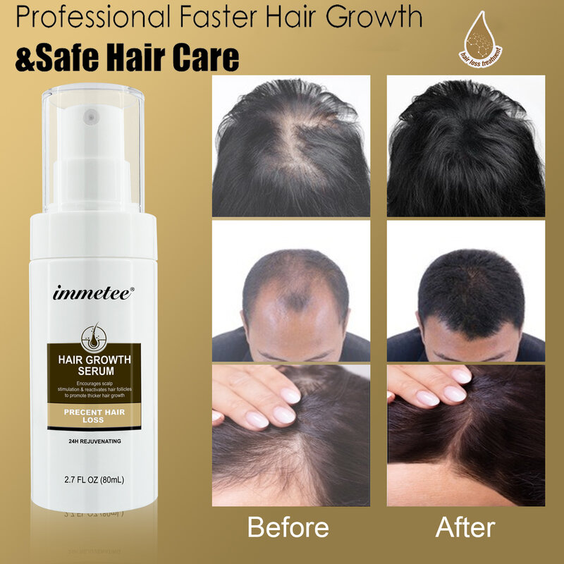Extracto de jengibre en Spray, suero para el crecimiento del cabello, pérdida de cabello productos Anti, reparación de raíces dañadas, tratamiento para el crecimiento del cabello para hombres/mujeres