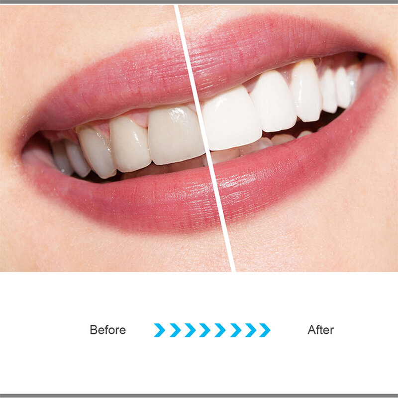 استبدال رؤوس لفرشاة الأسنان الكهربائية متوافق مع فيليبس Sonicare فرشاة الأسنان الكهربائية 2/3 سلسلة HX9023 HX6013/05 HX6930
