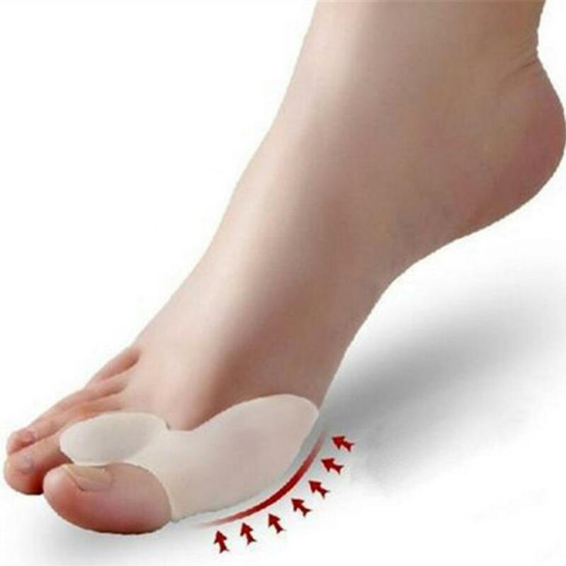Corretor de joanete de dedo do pé, endireitador de hálux valgus, alívio da dor, suprimentos para corretor de dedos dos pés, 1 peça