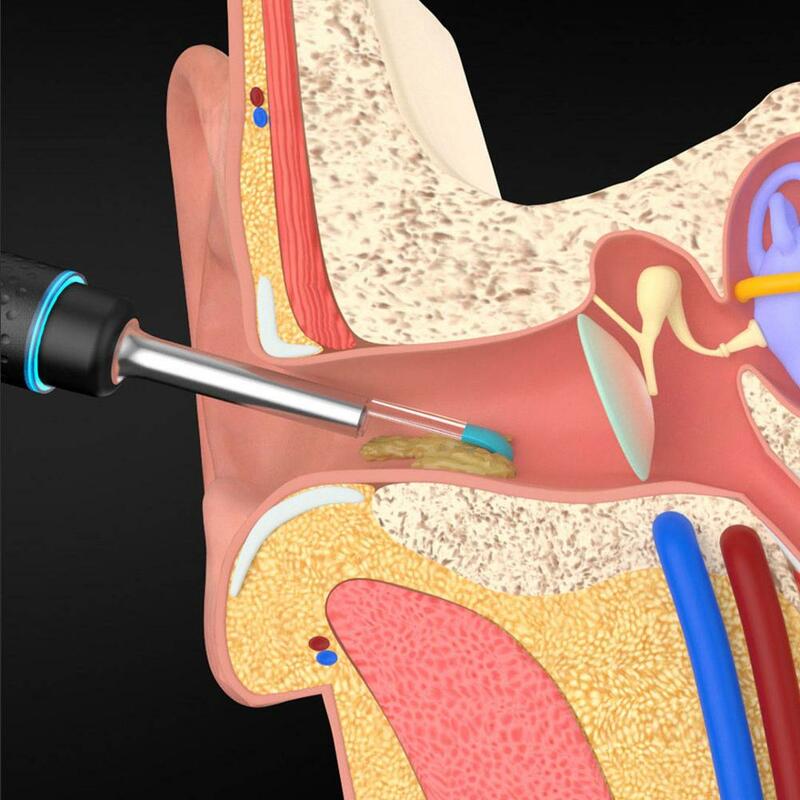Inteligentny wizualny pręt do zbierania uszu Bebird M9 Pro wielofunkcyjny endoskop ucha z magnetycznie naładowaną podstawą do WiFi