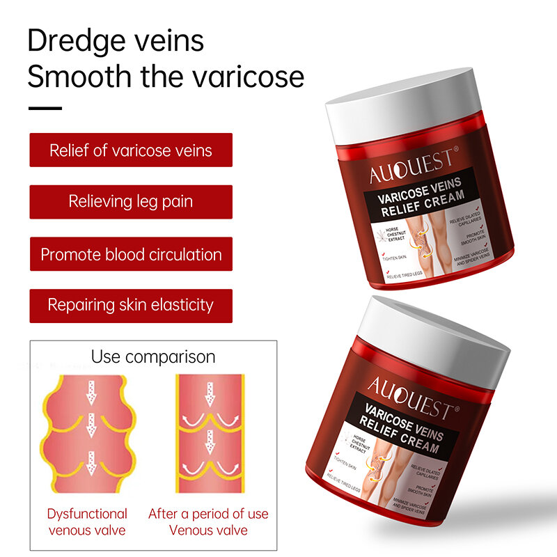 AUQUEST Varicose Veins Treatment Cream Relieve Tired Legs Dilated Vasculitis Phlebitis Spider Pain Relief Ointment Body Care 80g