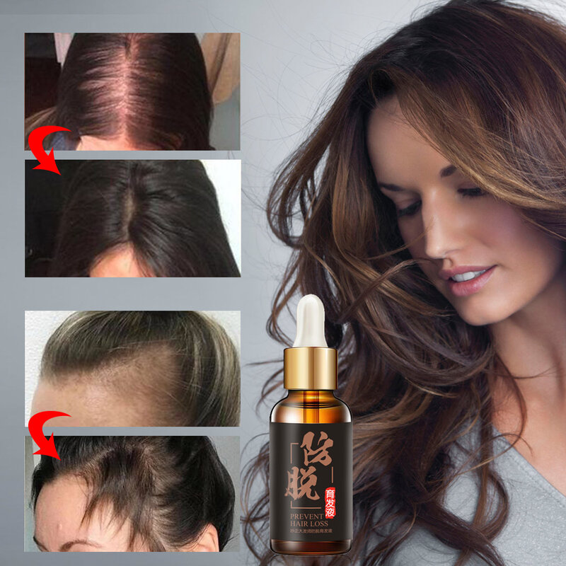 Hair Growth Treatment for Anti Hair Loss Products Beard Oil Repairs Damage Hair Root Hair Tonic Growth Hair Topical Solutions
