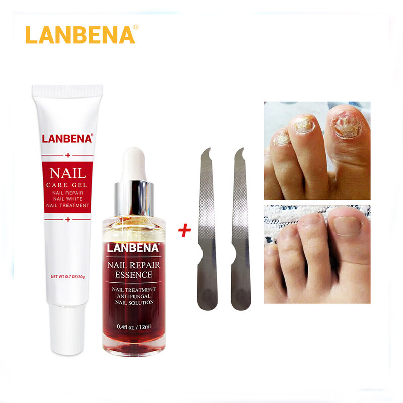 Уход за ногтями LANBENA гель для восстановления ногтей эссенция Сыворотка для лечения ногтей Удаление онихомикоза для пальцев ног питательный...
