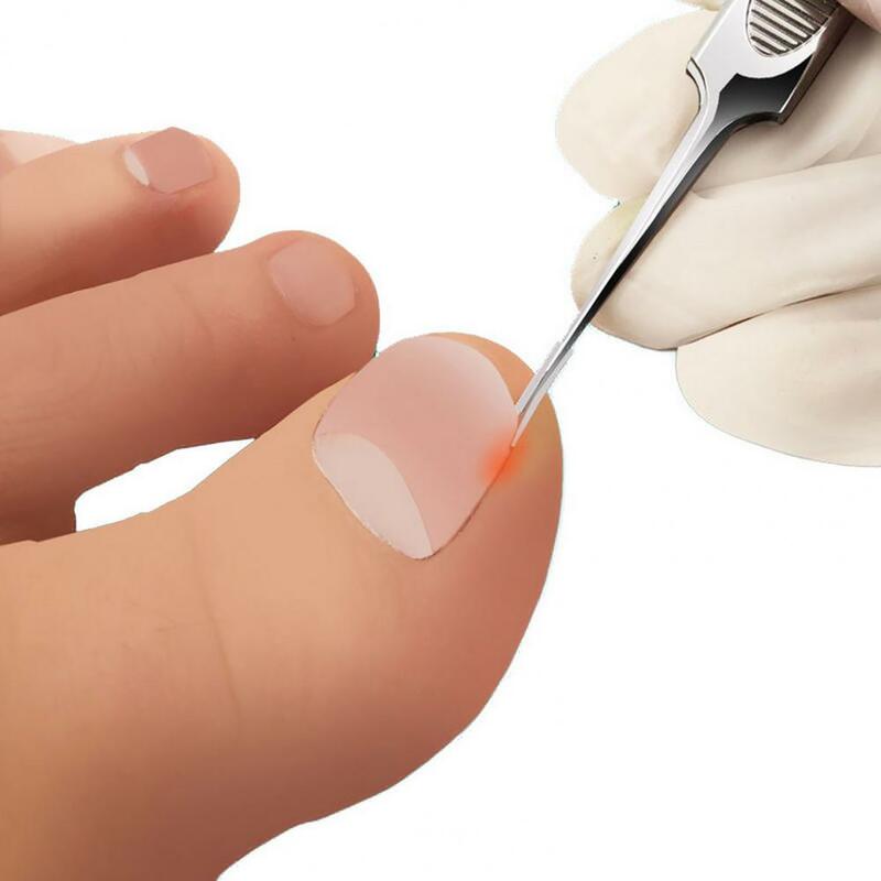 10 sztuk wrastające paznokieć narzędzie do korekcji wrastające Toe terapia na paznokcie elastyczna naszywka klip do prostowania Brace narzędzie do Pedicure