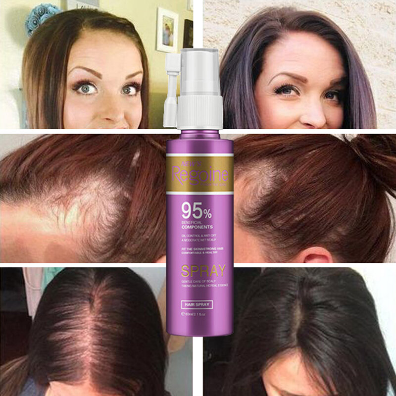 Espray de esencia de crecimiento de pelo de 60 ml para la pérdida de aceite de pelo rápido Thicken tratamiento tópico ayuda para el cabello de las mujeres soluciones