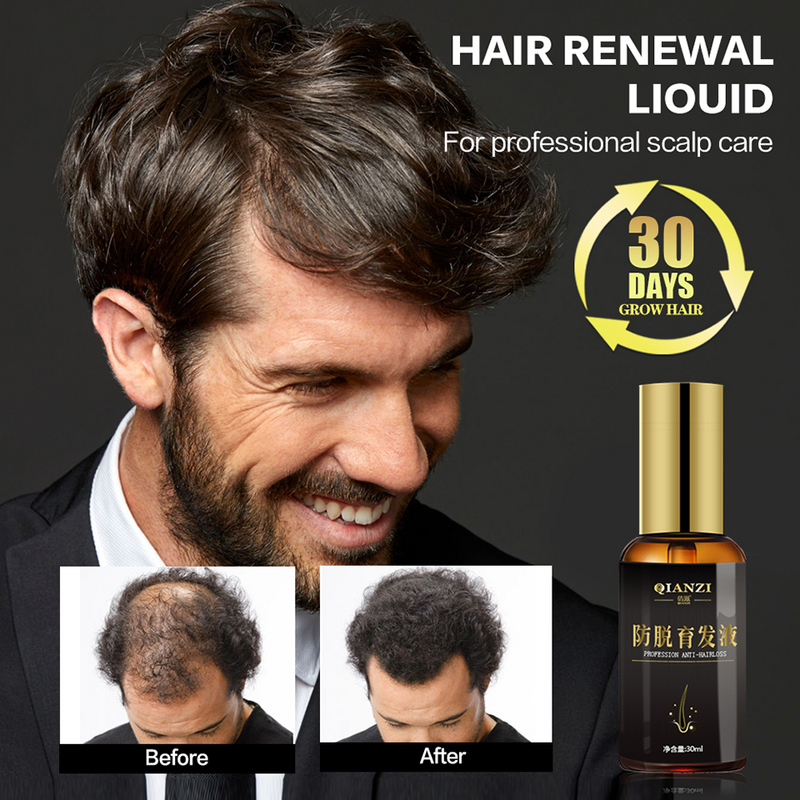 Hair Growth Essence Oil for Hair Growth Treatment Anti Hair Loss Products Hair Care Hair Tonic Solutions for Women Men Hair Loss