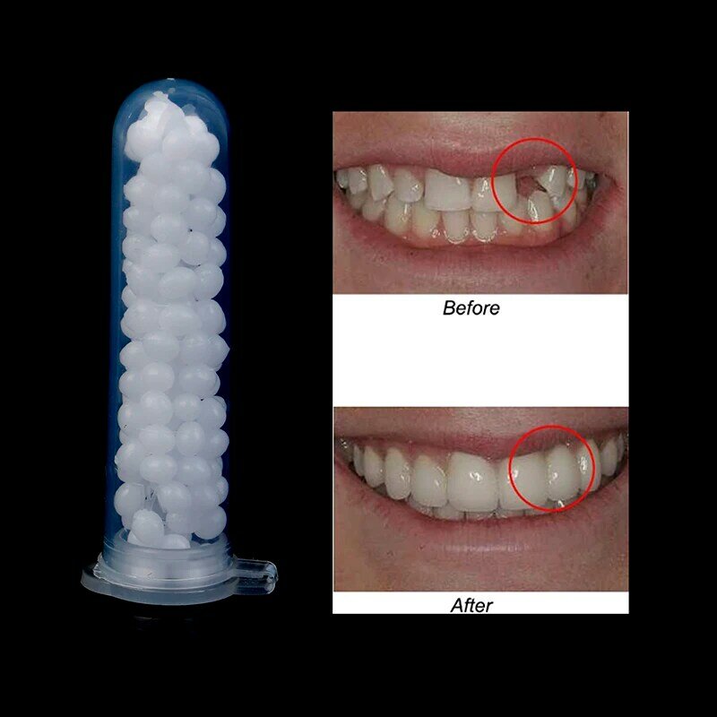 Kit di riparazione temporanea dei denti denti e spazi vuoti denti falsi colla solida protesi denti adesivi sbiancamento dei denti strumento di bellezza