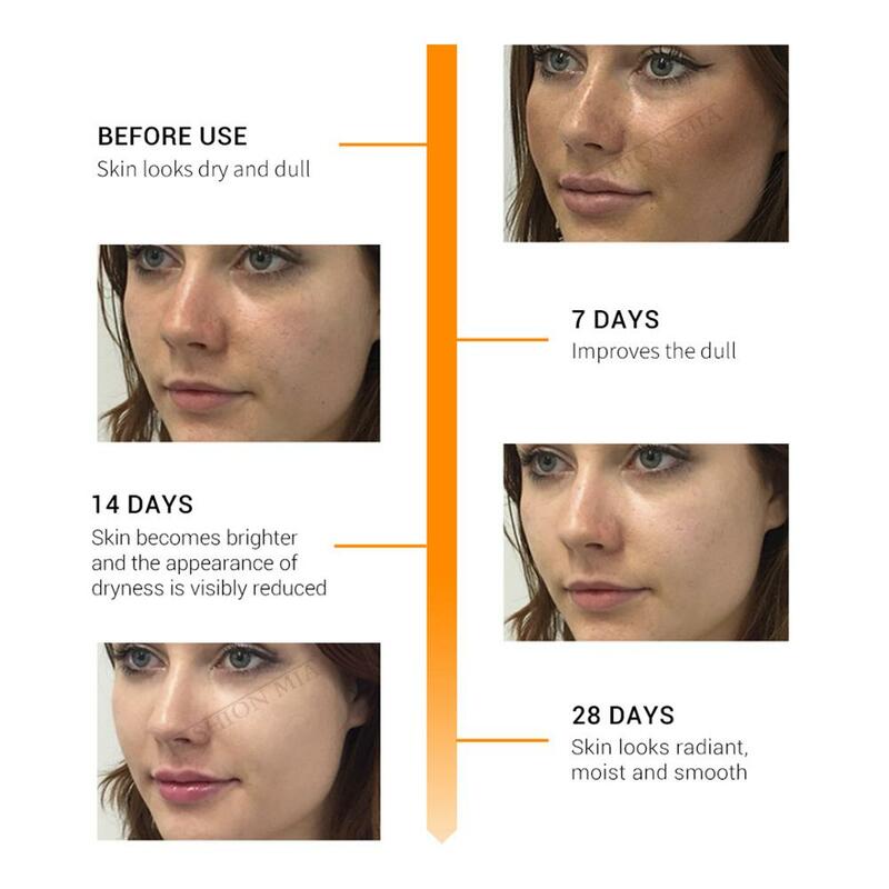 L'ordinaire AHA 30% + BHA 2% Solution de Peeling 10 minutes exfoliant visage 30ml sérum pour le visage supprimer les cicatrices d'acné blanchissant Original