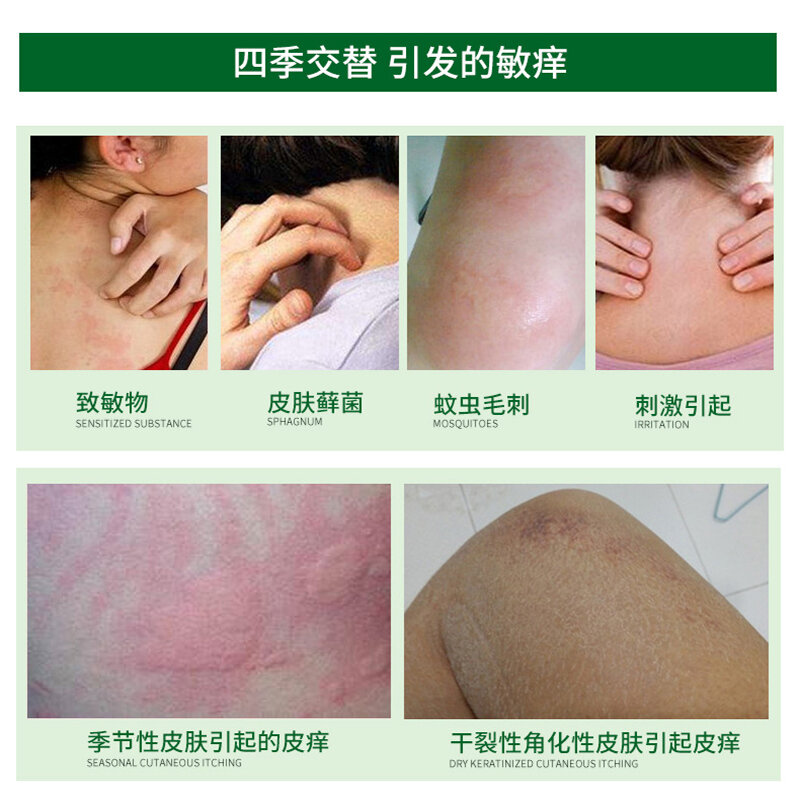 Gaitanling Piyanping – crème antibactérienne, anti-démangeaisons, rouges, gonflées et anti-mousse pour la peau, 20g