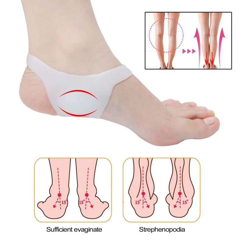 Sumifun-plantillas correctoras de pies tipo O para hombres y mujeres, almohadillas antideslizantes para zapatos, plantillas ortopédicas de silicona, C1476, 2 unidades