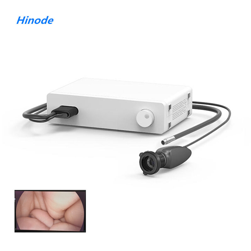 Cámara de vídeo HD 4K para cirugía médica, endoscopio integrado, LED, fuente de luz fría