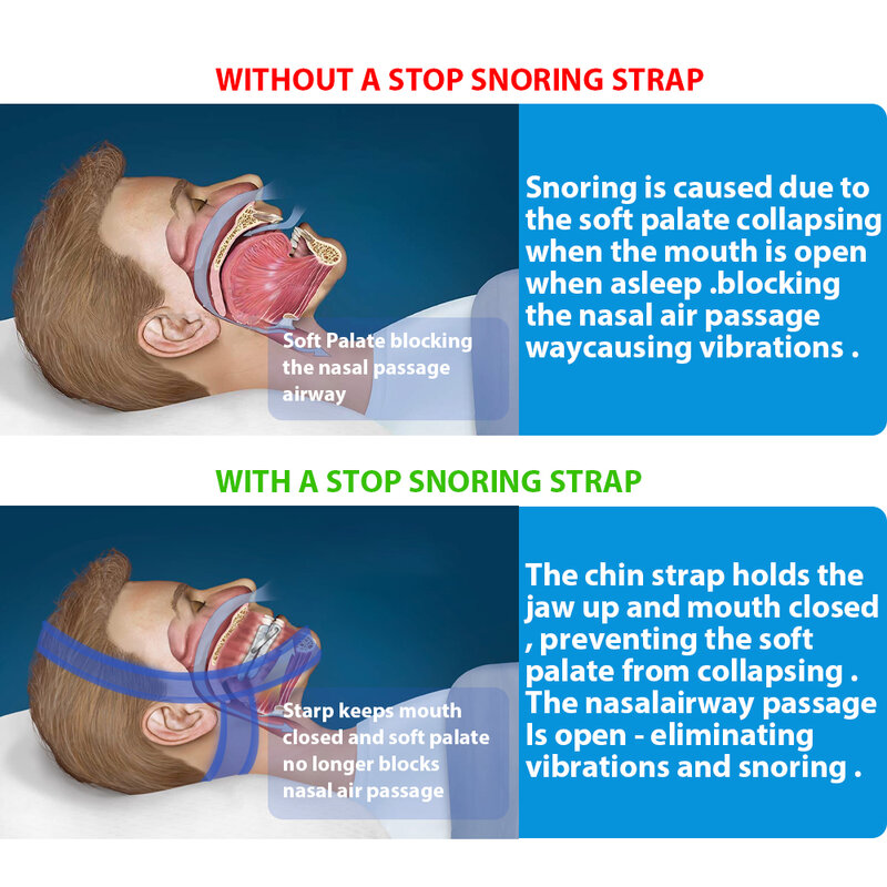 Nieuwe Neopreen Anti Snore Stop Snurken Chin Strap Riem Anti Apneu Kaak Oplossing Slaap Ondersteuning Apneu Riem Slapen Care Tools