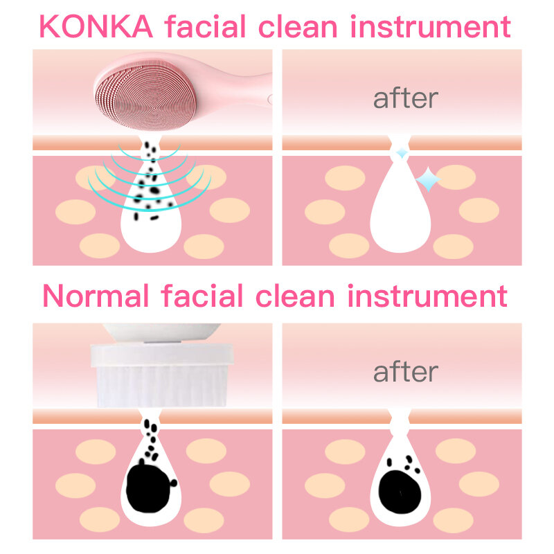 Konka silicone rosto escova de limpeza elétrica limpador facial elétrico limpeza da pele função limpeza profunda 3 em 1