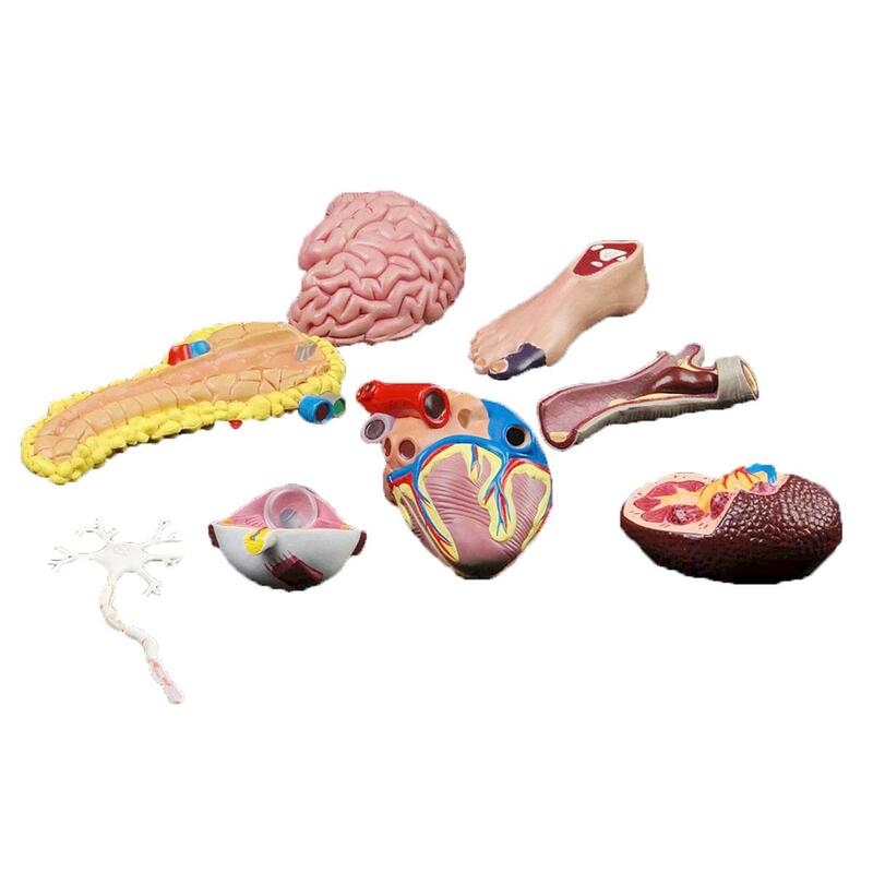 Komplikationen des menschlichen Diabetes modells Gehirn Herz Bauchsp eichel drüse neuronale Fuß Lehrmittel Bildung