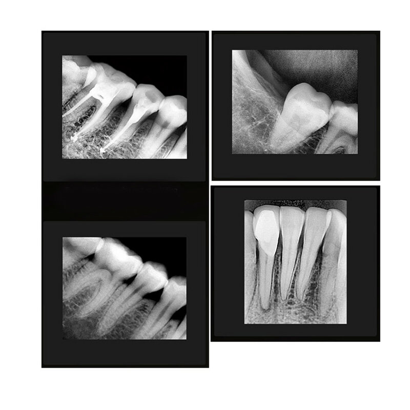 Novo tamanho maior 2 eco sensor ii usb dental x ray sensor intra oral câmera digital com suporte mais rápido/reciclar/durável