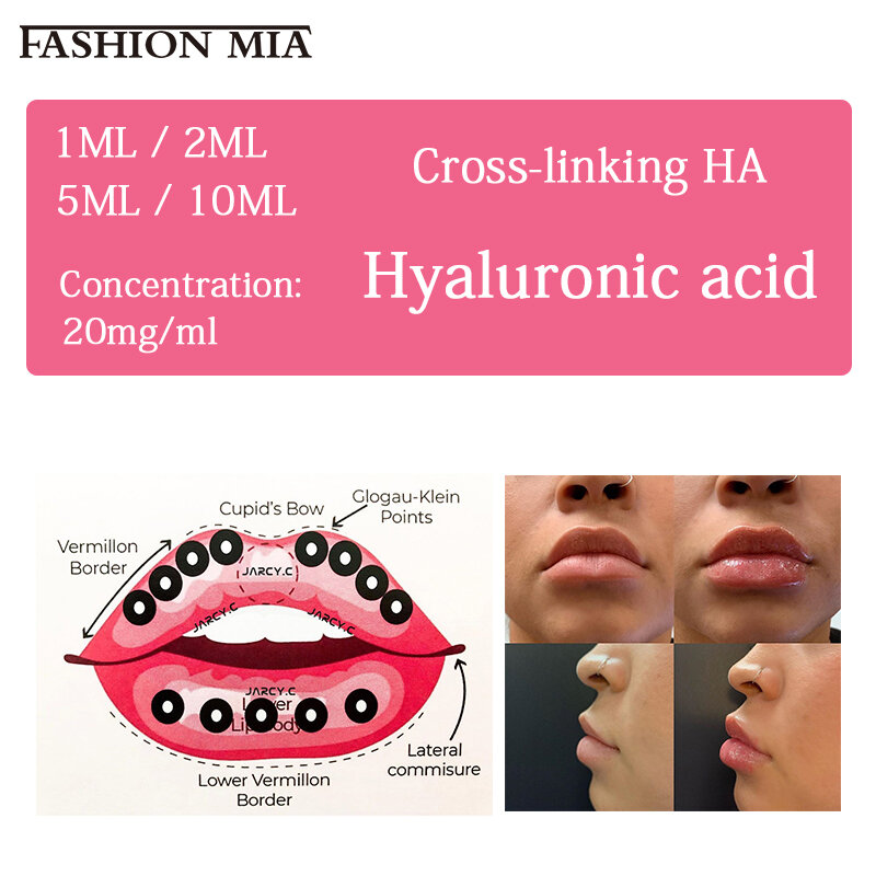 2ml/5ml/10ml lèvres acide hyaluronique avec boîte chaude