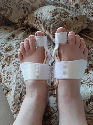 1/2PC Big Bone Toe borsite stecca raddrizzatore correttore, sollievo dal dolore del piede alluce valgo piedi cura protettore strumenti per la cura del piede