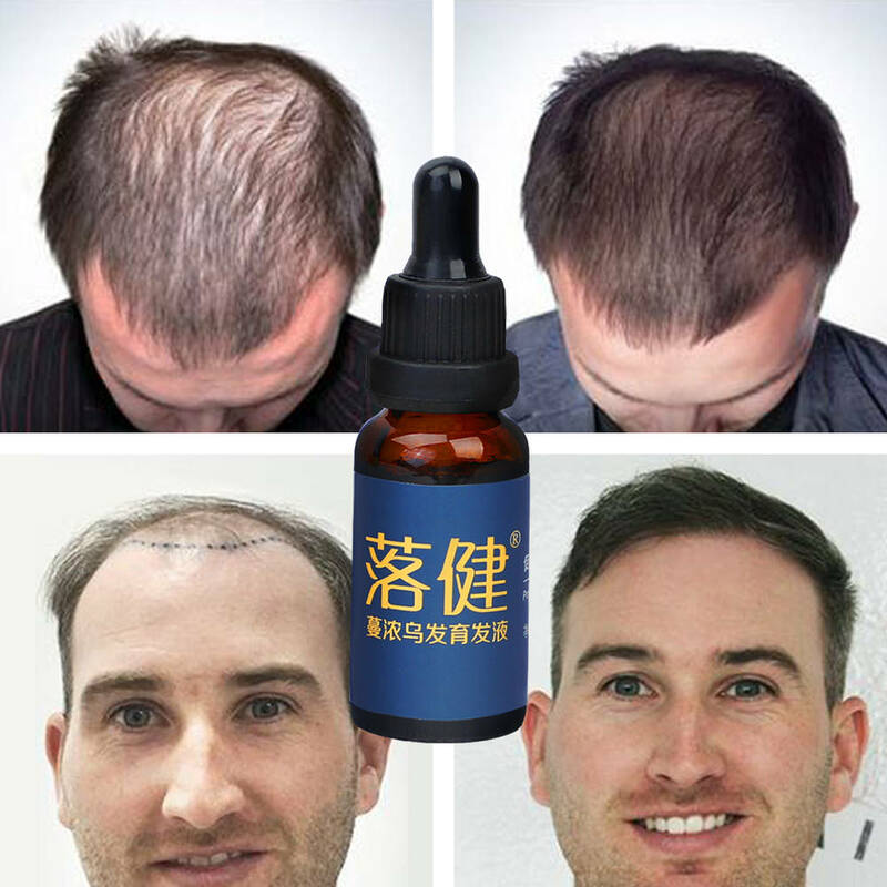 Óleo do crescimento da barba do tratamento da perda de cabelo do óleo da essência do crescimento do cabelo anti para produtos rápidos da perda de cabelo do crescimento do cabelo tônico do cabelo