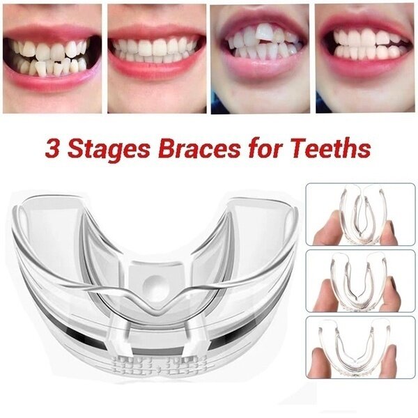 3 sztuk/zestaw do zębów z aparatem ortodontycznym trener Dental Tooth Appliance wyrównanie Brace materiał silikonowy profesjonalny straż teethstraighter