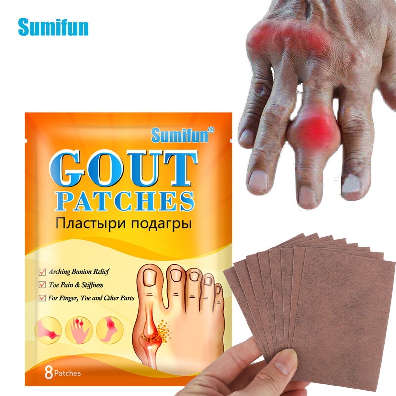 8-80 Stück Sumifun Gicht Behandlung Patch Finger Zehen Bunion Schmerz linderung medizinischen Gips Fuß Knochen Daumen Korrektor Aufkleber Pflege