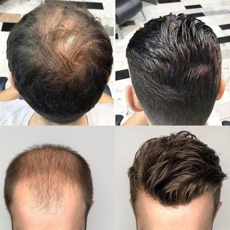 EVASFOS peruka włosy mężczyźni francuski koronki PU wokół protezy mężczyzn peruki System wymiany włosów czyste ręcznie robione Hairpiece dla mężczyzn peruki