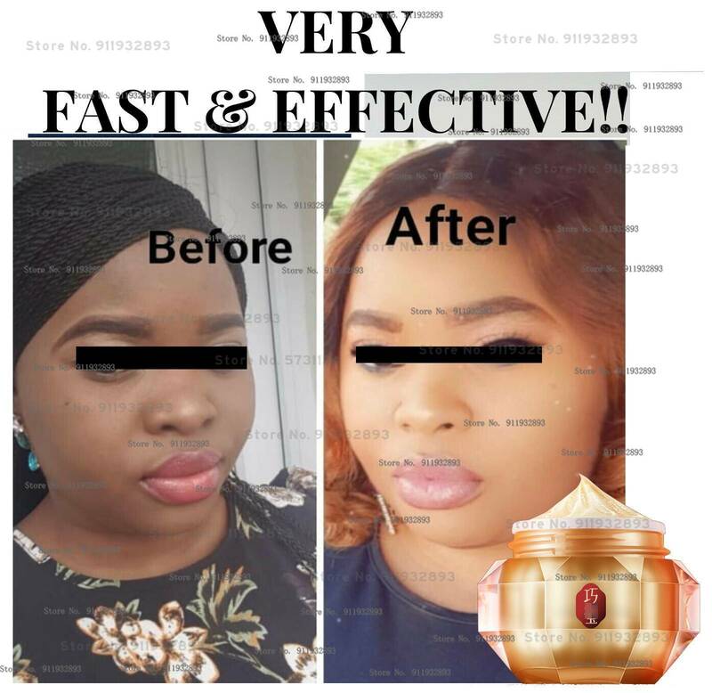 ACTIVE face cream, WHITENING/LIGHTENING and hyperpigmentation face cream