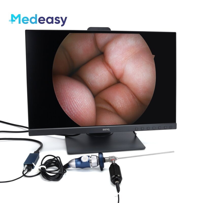كاميرا التنظير الطبي المحمولة ، جراحة الأنف والحنجرة ، USB ، Full HD ، 1080P ، HDMI ، مصدر ضوء مجاني