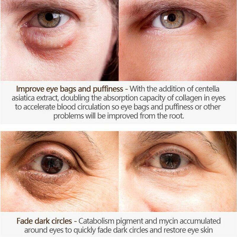 LAIKOU Eye Cream Mask Patch For Eyes Care Cream Anti-Wrinkle Remover Dark Circle Hydrogel Eye Bags Anti-Age Eye Care Skin