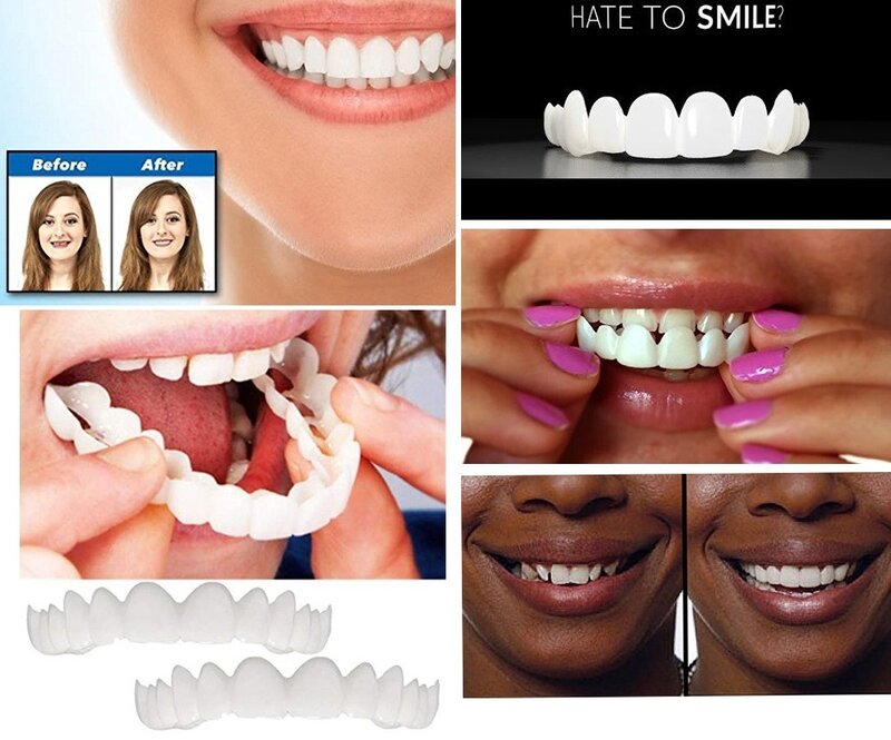 Górne i dolne zęby forniry anty-prawdziwe szelki Snap On Smile zęby wybielanie zębów protezy wygodne fornir pokrywa zęby