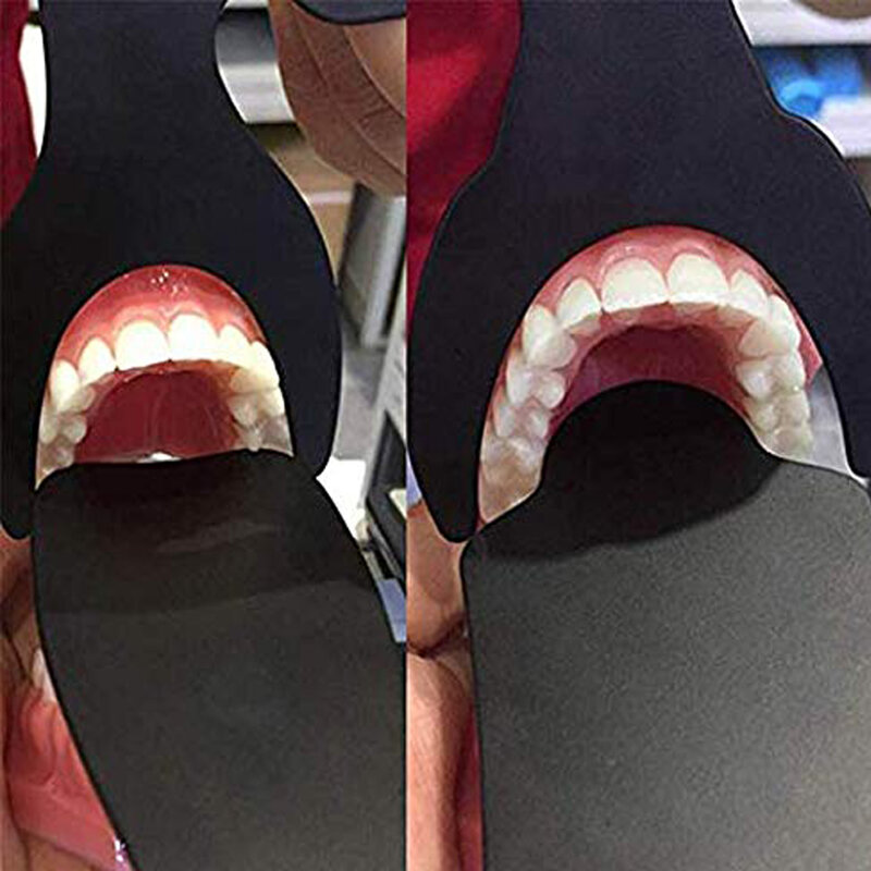 Espejo fotográfico Intraoral Autoclavable para dentista, tablero de fondo negro con contraste Dental, 6 unids/set