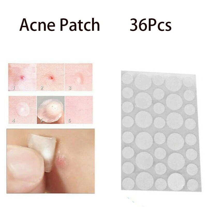 Parche de acné para cuidado de la piel, pegatinas de 36 piezas para terapia de acné, removedor de granos, herramienta para manchas, mascarilla Facial, parches impermeables, envío directo