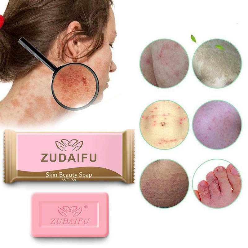 Sabonete de enxofre para desinfecção, portátil, limpeza da pele, acne, antifúngico, sabão de banho, feito à mão, 7g, beleza cosmética