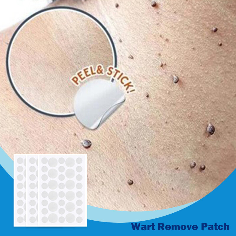 108Pcs Skin Tag Remover Warts Remover Patch Wart ครีมสมุนไพรสารสกัดจากข้าวโพดฉาบสิวหูดครีม