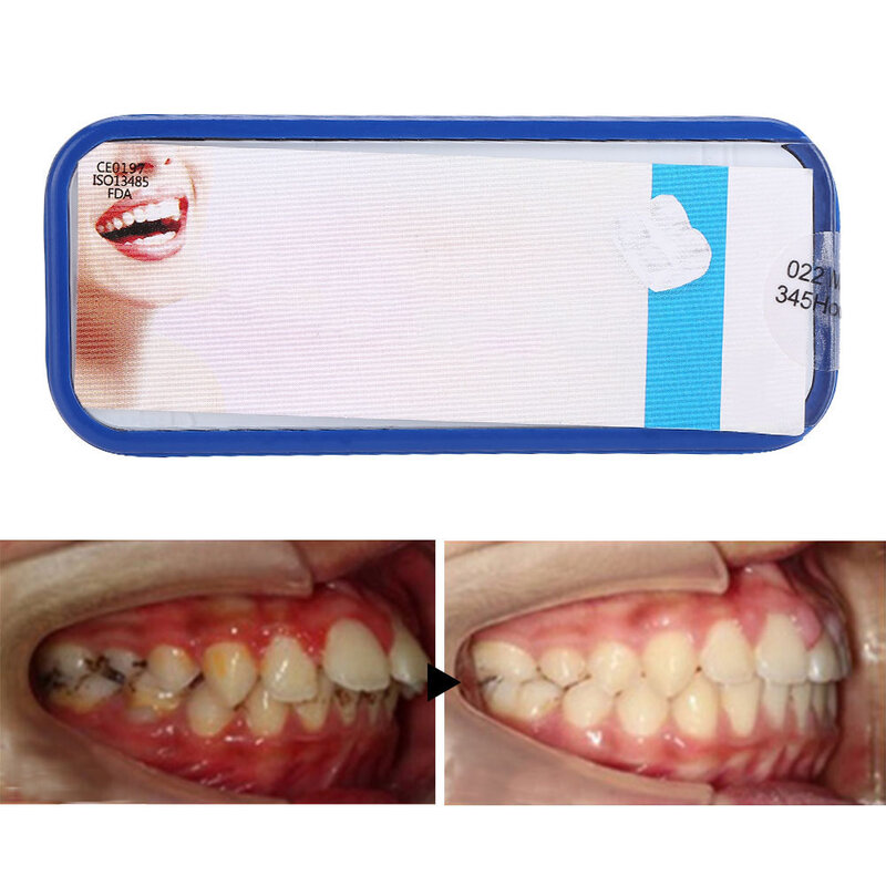 20 قطعة المواد المعدنية الأسنان تقويم الأسنان دعامات سيراميك روث 022 فتحة 345 مع هوك غير سامة مستقرة العلاج عن طريق الفم الملحقات