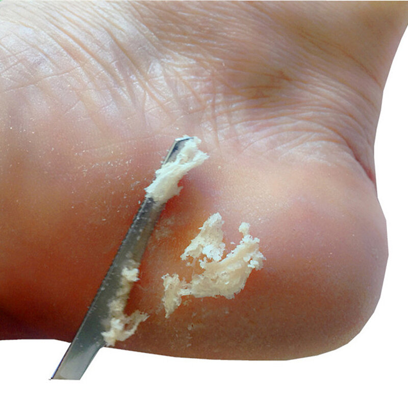 1 pc profissional pé raspador de aço inoxidável cuidados com os pés pedicure raspador portátil cortador de unhas esfoliante ferramenta