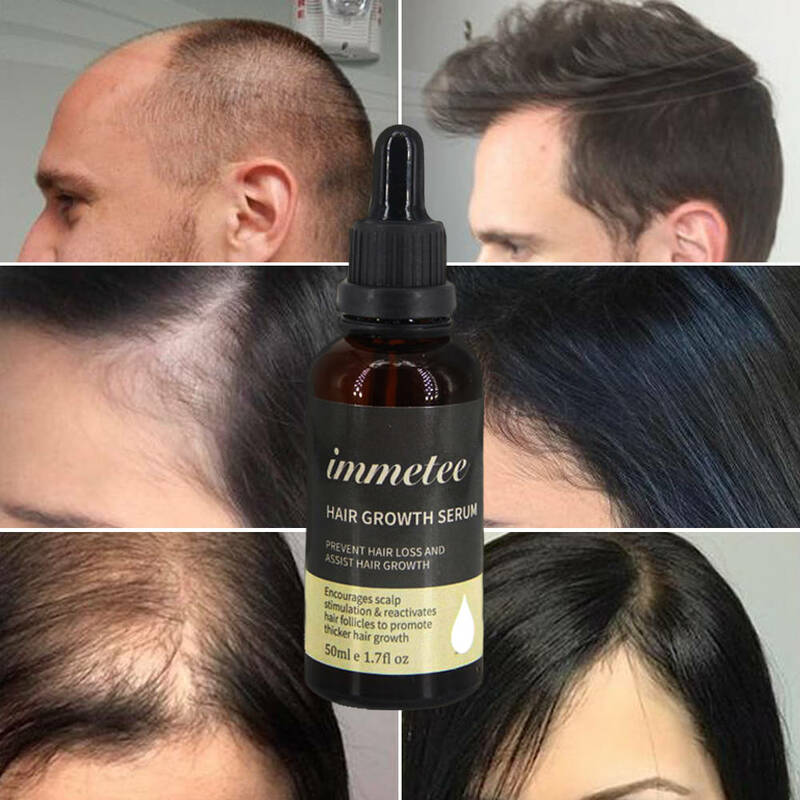 Aceite esencial para el crecimiento del cabello, tratamiento antipérdida de cabello, aceite para el crecimiento rápido de la barba, productos para la pérdida del cabello, tónico para el cuidado del cabello