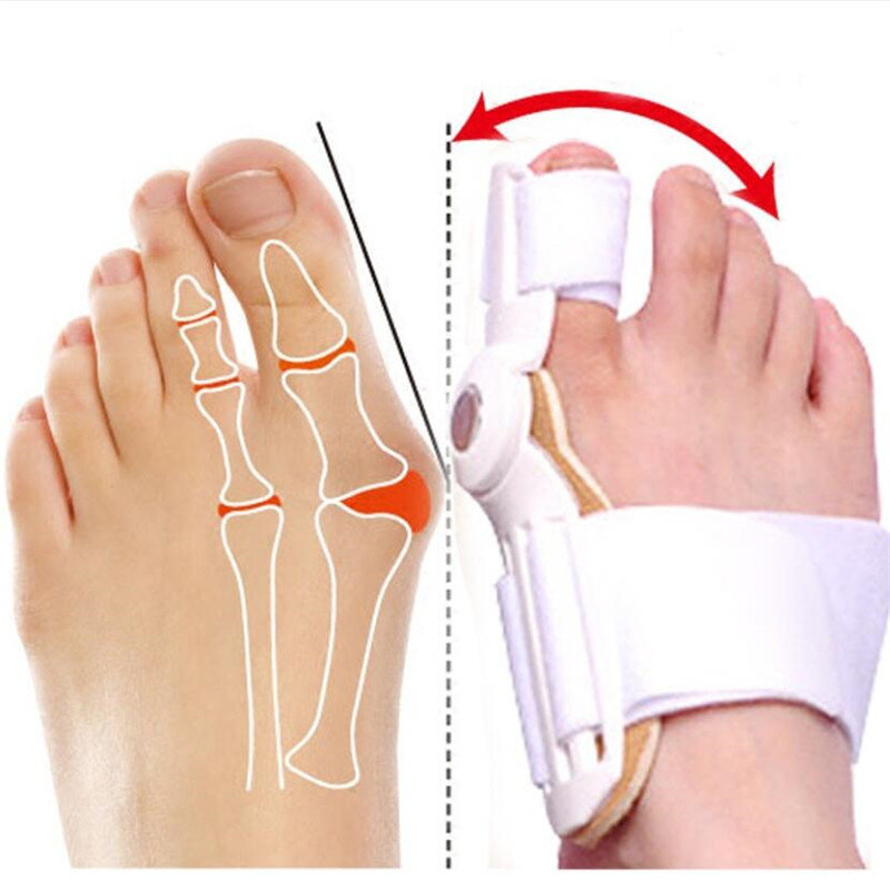 ビッグボーントゥ外反母趾副子矯正器、足のケアプロテクター、足の痛みの緩和、外反母趾矯正器、1個