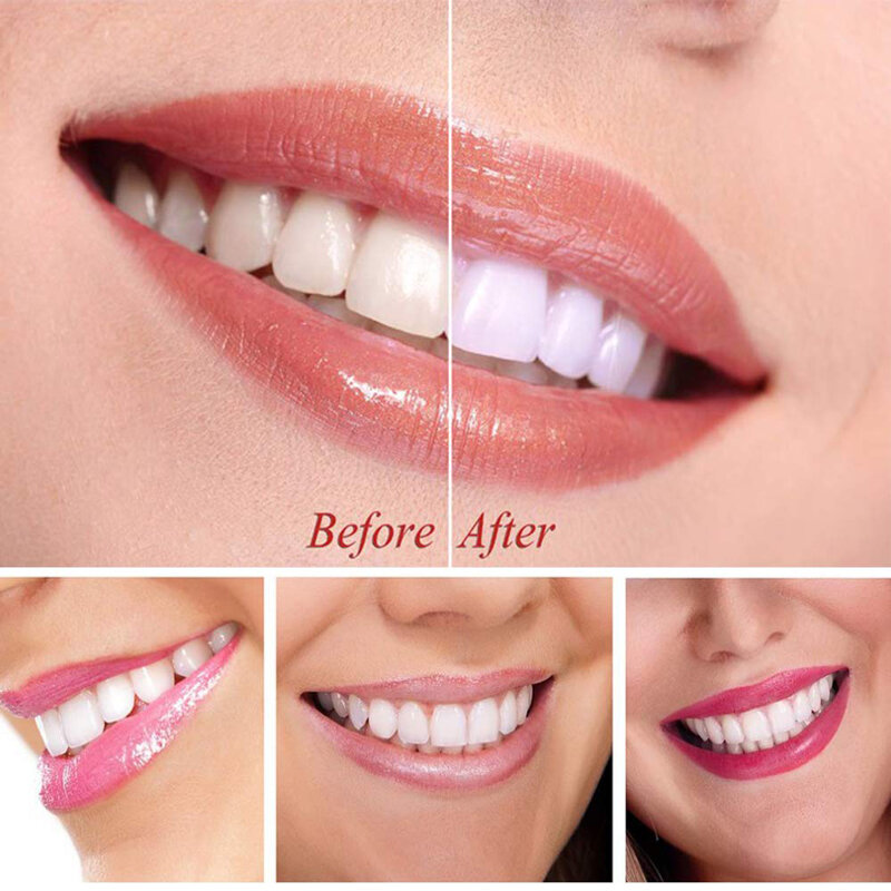 2 sztuk pisak do wybielania zębów czyszczenie Serum plakietka plamy Remover zęby Bleachment Dental Whitener higiena jamy ustnej pielęgnacja zębów wybielacz