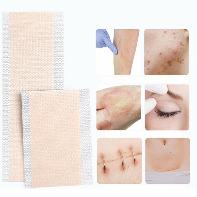 Fita adesiva para cicatriz, adesivo invisível para cirurgia de cor de pele, acne, cicatriz, gel de silicone